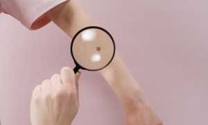 neo dermatologia