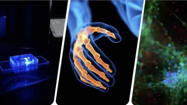 upo flamingo artrite