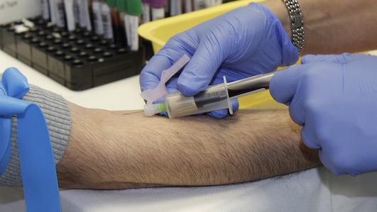 prelievo sangue
