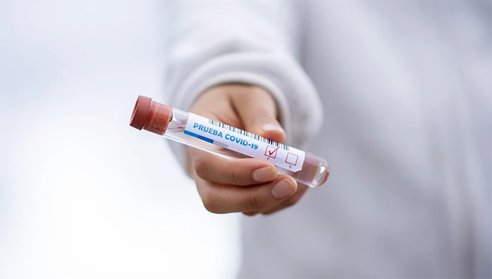 Approvato il protocollo regionale per la gestione dei test sierologici